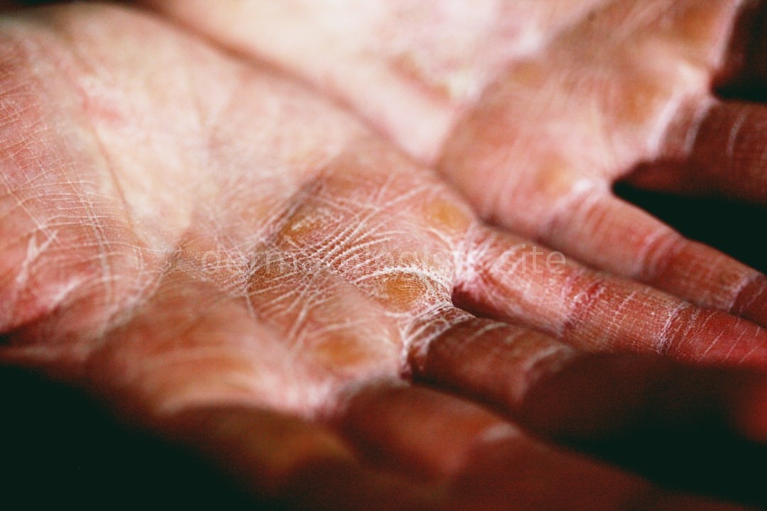 Skin Detail
